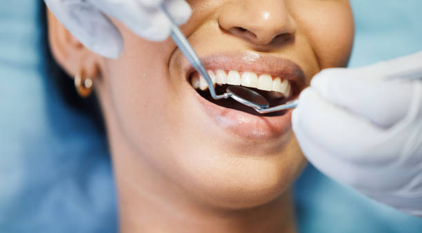 Best Emergency Dentist for Lost Fillings or Crowns in Snowflake, AZ